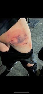 Julia Leggett alleges she was injured by police while peacefully protesting in Portland. She has filed a lawsuit. 