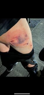 Julia Leggett alleges she was injured by police while peacefully protesting in Portland. She has filed a lawsuit. 