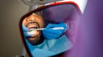 The gloved hands of a dental worker can be seen reflected in a mirror as they clean the teeth of a patient.