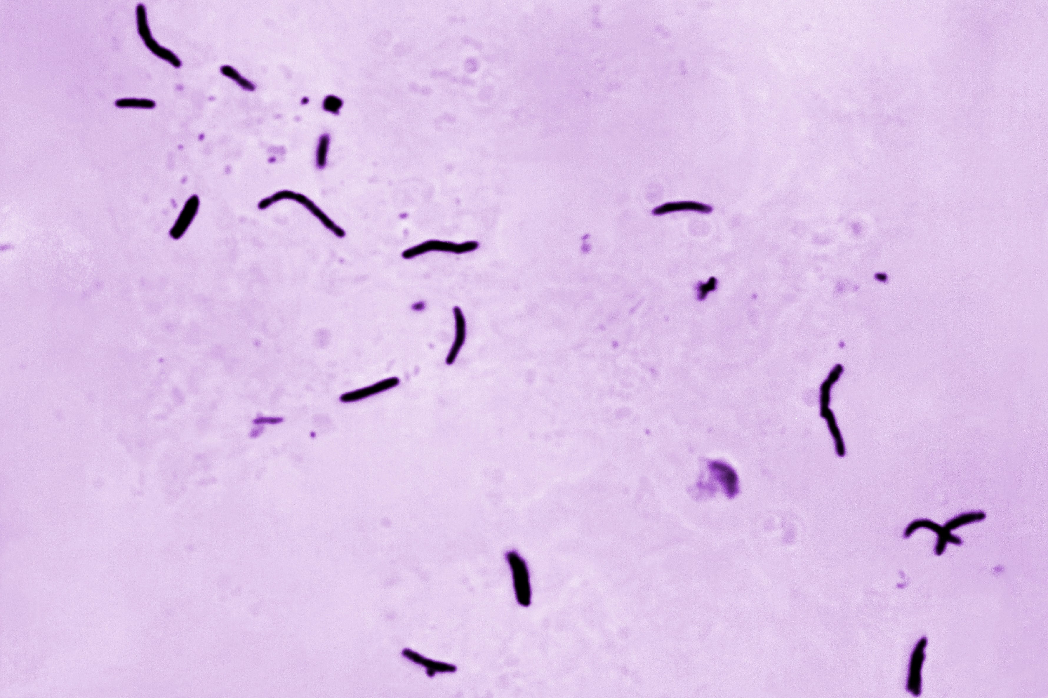 FILE - This 1966 microscope photo provided by the U.S. Centers for Disease Control and Prevention shows Mycobacterium tuberculosis bacilli, the organism responsible for causing the disease tuberculosis. Multnomah County health officials have confirmed one case of active tuberculosis at a middle school in Southeast Portland on May 15, 2025. (Elizabeth S. Mingioli/CDC via AP)