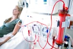 The core technology used in dialysis machines was first developed for NASA.