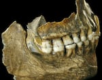 The complete jaw of a Neanderthal individual found in Spy, Belgium. Small and thin tartar deposits provided the researchers with enough DNA sequences to study.
