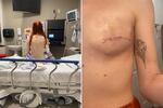 Two photographs of Abigail Glavy are shown. At left, we she her bare back as she sits on a hospital bed. She has two long red braids.
